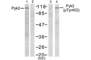 Western blot analysis of extract from Jurkat cells, untreated or treated with PMA (1ng/ml, 5min), using Pyk2 (Ab-402) antibody (E021209, Lane 1 and 2) and Pyk2 (phospho- Tyr402) antibody (E011216, Lane 3 and 4). (PTK2B anticorps  (pTyr402))
