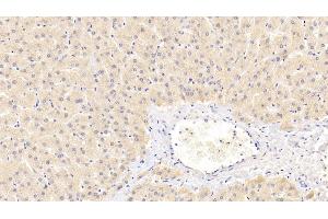 Detection of PEX2 in Human Liver Tissue using Polyclonal Antibody to Peroxisomal Biogenesis Factor 2 (PEX2)