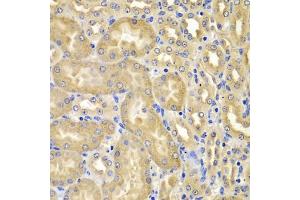 Immunohistochemistry of paraffin-embedded mouse kidney using XIAP antibody (ABIN5974139) at dilution of 1/100 (40x lens). (XIAP anticorps)