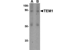 Western blot analysis of TEM1 in human colon tissue lysate with this product at (A) 0. (CD248 anticorps  (N-Term))