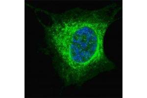 Fluorescent confocal image of SY5Y cells stained with Vimentin antibody at 1:200. (Vimentin anticorps  (AA 63-90))