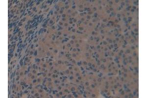 DAB staining on IHC-P; Samples: Mouse Ovary Tissue (Galectin 6 anticorps  (AA 1-301))