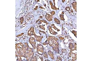 IHC analysis of TOMM34 using anti-TOMM34 antibody (ABIN7599253). (TOMM34 anticorps  (AA 1-309))