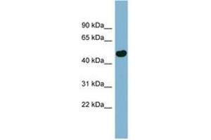 Image no. 1 for anti-EF-Hand Calcium Binding Domain 4B (EFCAB4B) (AA 71-120) antibody (ABIN6741790) (EFCAB4B anticorps  (AA 71-120))