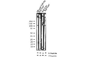 Western blot analysis of Phospho-c-PLA2 (Ser505) expression in various lysates