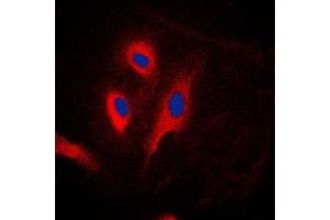 Immunofluorescent analysis of CARD6 staining in Jurkat cells.