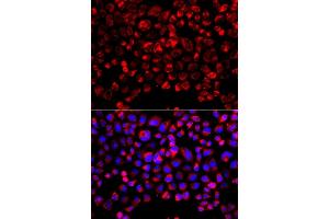 Immunofluorescence analysis of  cells using SULT1E1 antibody (ABIN6129758, ABIN6148714, ABIN6148715 and ABIN6223332).