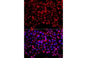 Immunofluorescence analysis of  cells using SULT1E1 antibody (ABIN6129758, ABIN6148714, ABIN6148715 and ABIN6223332). (SULT1E1 anticorps  (AA 140-294))