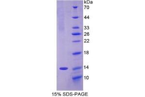 SDS-PAGE analysis of Rat Olfactomedin 4 Protein.
