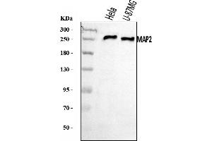 Western blot analysis of MAP2 using anti-MAP2 antibody (ABIN7601483).