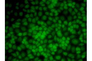 Immunofluorescence analysis of HeLa cells using UMPS antibody.