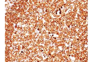Formalin-fixed, paraffin-embedded human Tonsil stained with CD79a Monoclonal Antibody (SPM549) (CD79a anticorps  (AA 202-216))