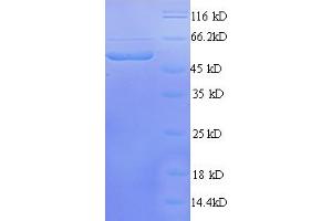 SDS-PAGE (SDS) image for Solute Carrier Family 12 (Potassium-Chloride Transporter) Member 7 (SLC12A7) (AA 1-474), (full length) protein (His tag) (ABIN5709185)