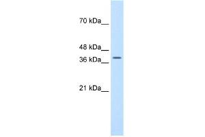 WB Suggested Anti-TFB2M Antibody Titration:  1. (TFB2M anticorps  (N-Term))