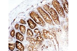IHC-F testing of VCP antibody and rat intestine tissue (VCP anticorps  (C-Term))