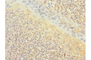 Immunohistochemistry of paraffin-embedded human tonsil tissue using ABIN7171372 at dilution of 1:100 (CD1c anticorps  (AA 18-300))