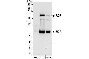anti-Rab11 Family-Interacting Protein 1 (RAB11FIP1) (AA 1233-1283) antibody