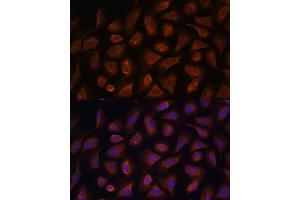 Immunofluorescence analysis of U-2 OS cells using TSLP antibody (ABIN6128843, ABIN6149624, ABIN6149626 and ABIN6217014) at dilution of 1:100.