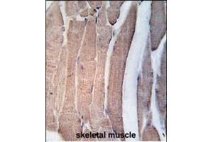 Formalin-fixed and paraffin-embedded human skeletal muscle tissue reacted with DK2 Antibody (N-term V55) 7218a , which was peroxidase-conjugated to the secondary antibody, followed by DAB staining. (DAPK2 anticorps  (N-Term))