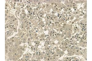 ABIN6255875 and ABIN6267214 at 1/100 staining human normal lung tissue by IHC-P. (CDK6 anticorps  (pTyr292))