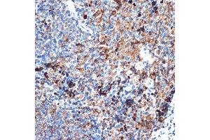 Immunohistochemistry of paraffin-embedded rat spleen using CRMP5/DPYSL5 Rabbit mAb (ABIN7266774) at dilution of 1:100 (40x lens). (DPYSL5 anticorps)