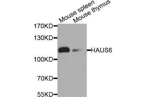Western Blotting (WB) image for anti-HAUS Augmin-Like Complex, Subunit 6 (HAUS6) (AA 676-955) antibody (ABIN1679814) (FAM29A anticorps  (AA 676-955))