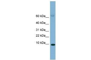 WB Suggested Anti-SAA4 Antibody Titration:  0. (SAA4 anticorps  (Middle Region))