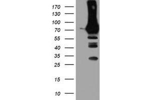 Western Blotting (WB) image for anti-phosphofructokinase, Platelet (PFKP) antibody (ABIN1500164) (PFKP anticorps)