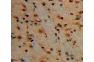Used in DAB staining on fromalin fixed paraffin-embedded Brain tissue