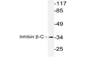 Western blot (WB) analysis of Inhibin beta-C antibody in extracts from A549 cells. (INHBC anticorps)