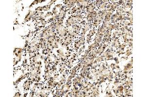 IHC analysis of LSM2 using anti-LSM2 antibody (ABIN7602832).