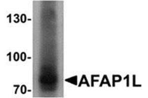 Western blot analysis of AFAP1L1 in A549 cell lysate with AFAP1L1 Cat. (AFAP1L1 anticorps  (N-Term))
