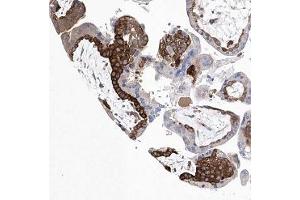 Immunohistochemical staining of human placenta with C14orf100 polyclonal antibody ( Cat # PAB28315 ) shows strong cytoplasmic positivity in trophoblastic cells. (JKAMP anticorps)