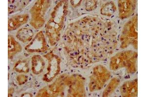 IHC image of ABIN7161352 diluted at 1:400 and staining in paraffin-embedded human kidney tissue performed on a Leica BondTM system.