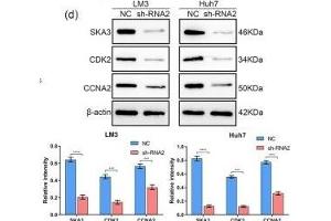 Downregulation of SKA3 affects the cell cycle in HCC cells. (SKA3 anticorps  (AA 201-300))