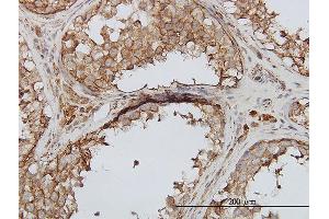Immunoperoxidase of monoclonal antibody to PIP5K3 on formalin-fixed paraffin-embedded human testis.