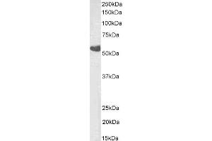 ABIN4902780 (0. (TBXA2R anticorps  (Isoform beta))