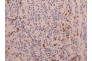 DAB staining on IHC-P; Samples: Human Spleen Tissue (LAMC3 anticorps  (AA 1250-1418))