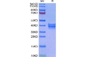 NKG2C & CD94 (AA 98-231) protein (His tag,DYKDDDDK Tag)