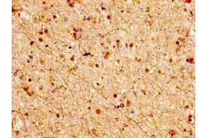 IHC image of ABIN7158074 diluted at 1:100 and staining in paraffin-embedded human brain tissue performed on a Leica BondTM system. (LGI2 anticorps  (AA 194-310))