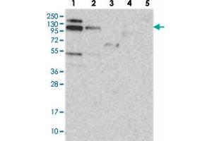 Western blot analysis of Lane 1: RT-4, Lane 2: U-251 MG, Lane 3: Human Plasma, Lane 4: Liver, Lane 5: Tonsil with RBM15B polyclonal antibody  at 1:250-1:500 dilution. (RBM15B anticorps)