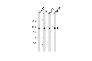 All lanes : Anti-DLG1 Antibody (Center) at 1:2000 dilution Lane 1: 293T/17 whole cell lysate Lane 2: Hela whole cell lysate Lane 3: MCF-7 whole cell lysate Lane 4: SH-SY5Y whole cell lysate Lysates/proteins at 20 μg per lane. (DLG1 anticorps  (AA 643-673))