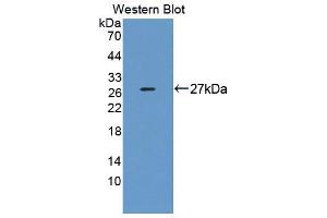 Western blot analysis of the recombinant protein. (DNAJC2 anticorps  (AA 442-621))
