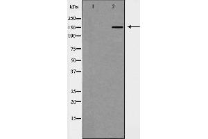 Western blot analysis of Hela cell lysate, using WHSC1L1 Antibody. (WHSC1L1 anticorps  (N-Term))