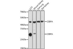 Western blot analysis of extracts of various cell lines, using CEBPA antibody ( ABIN6131380, ABIN6138380, ABIN6138381 and ABIN6214018) at 1:1000 dilution. (CEBPA anticorps  (AA 1-205))