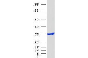 Validation with Western Blot