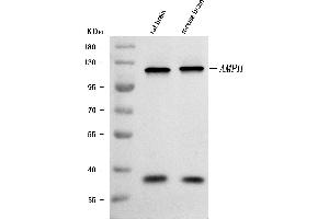 Western blot analysis of Amphiphysin/AMPH using anti-Amphiphysin/AMPH antibody (ABIN7602082).