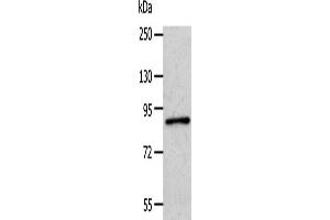Western Blotting (WB) image for anti-Adaptor Protein, phosphotyrosine Interaction, PH Domain and Leucine Zipper Containing 1 (APPL1) antibody (ABIN2421251)