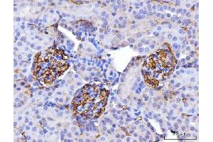 IHC analysis of CD147/Emmprin using anti-CD147/Emmprin antibody (ABIN7599997).