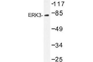 Image no. 1 for anti-Mitogen-Activated Protein Kinase 6 (MAPK6) antibody (ABIN317885) (MAPK6 anticorps)